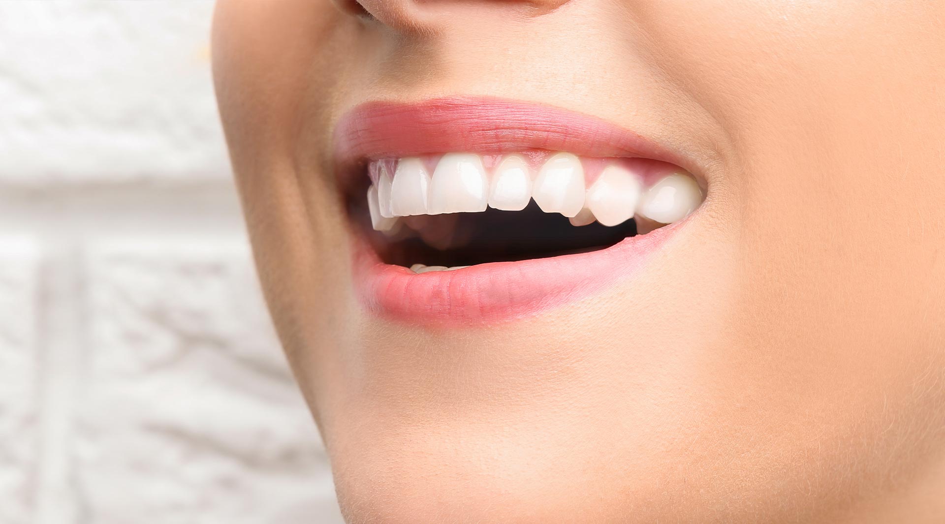 The image shows a close-up of a person s smiling face with an open mouth, revealing teeth and a red lipstick mark. The photo appears to be taken from a lower angle looking up at the subject, who has dark hair and fair skin.