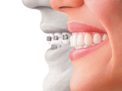 The image shows a split-screen comparison of a person s face with a dental implant on one side and a natural tooth structure on the other, highlighting the difference between the two.