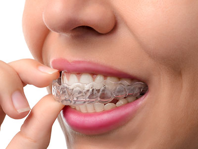 The image shows a person holding their teeth with their fingers, possibly examining them closely.