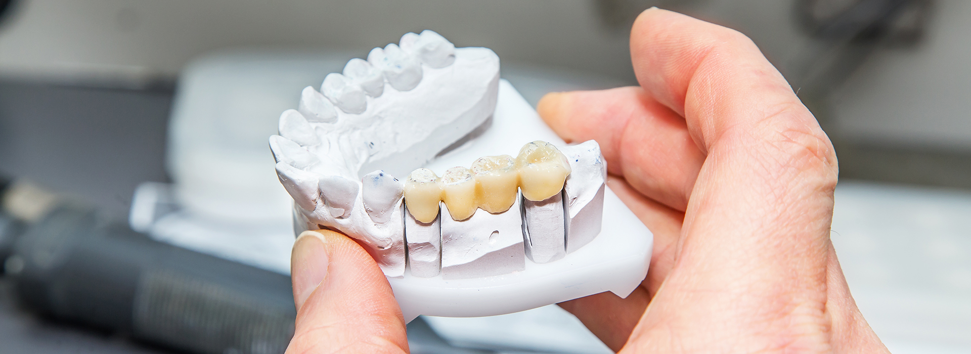 The image shows a person holding a three-dimensional printed dental model with a focus on the teeth area, highlighting the details of the tooth structure.