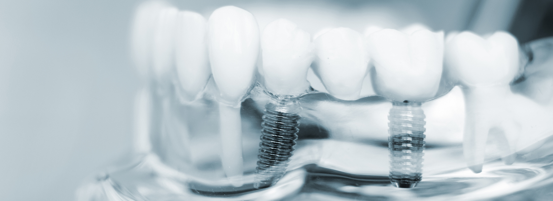 The image shows a close-up view of multiple toothbrushes with bristles, placed in an upright position against a blurred background.