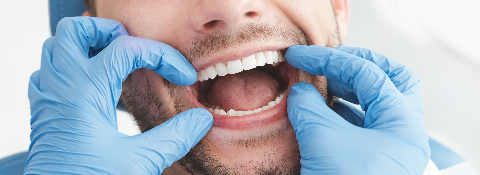 A man with his mouth open is being attended to by dental professionals wearing blue gloves and masks.