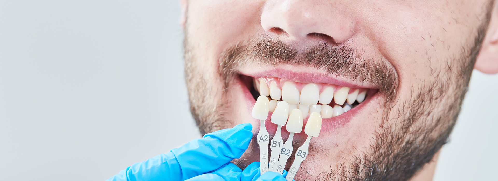 The image shows a person smiling with a toothbrush in their mouth, likely for dental hygiene purposes.
