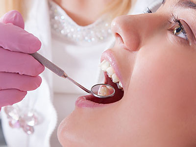 A woman with her mouth open wide, receiving dental care from a dentist who is using a drill on her teeth.