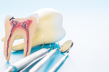 The image shows two dental models with teeth, positioned side by side on a table, with medical instruments such as tweezers and a toothbrush nearby, suggesting a dental examination or treatment setting.